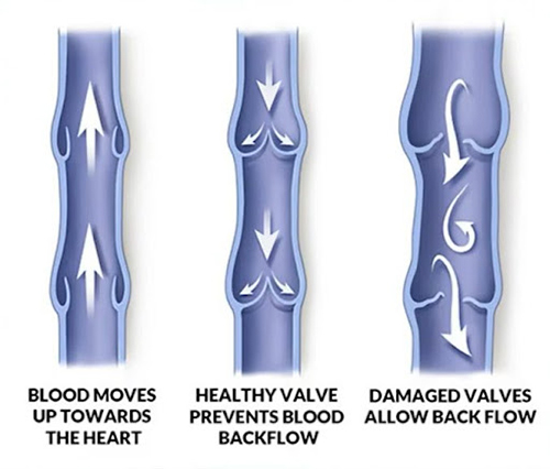normal leg circulation