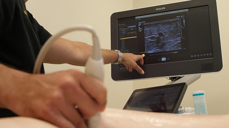 Early Signs of Chronic Venous Insufficiency: Symptoms You Shouldn’t Ignore